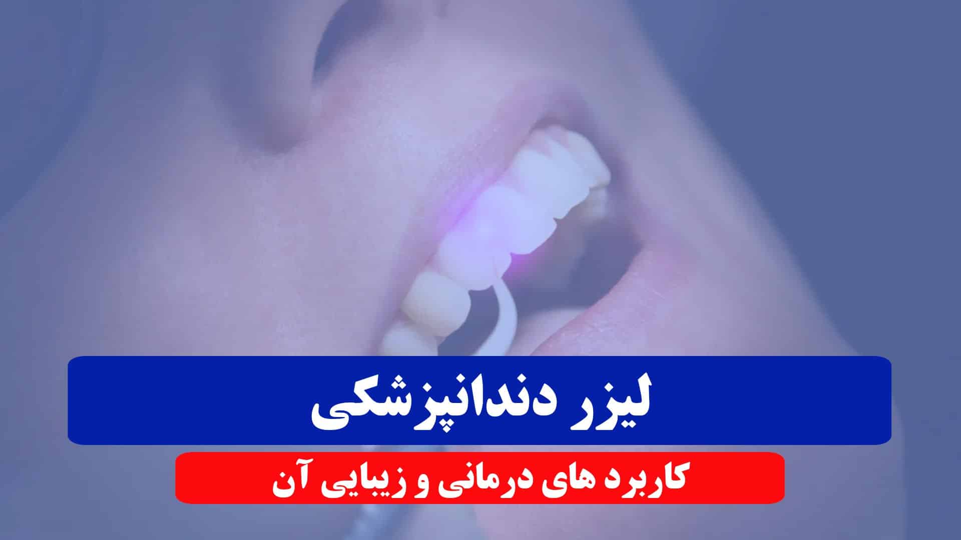 لیزر دندانپزشکی و کاربرد های آن